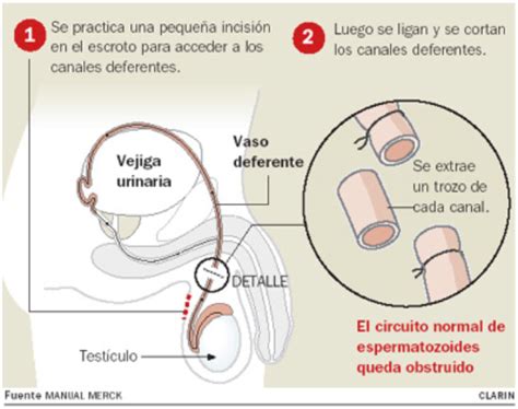 Vasectomía Urólogo Salamanca · Urología · Fisioterapia · Clínica