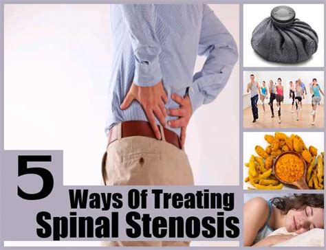 5 Effective Ways Of Treating Spinal Stenosis Natural Home Remedies