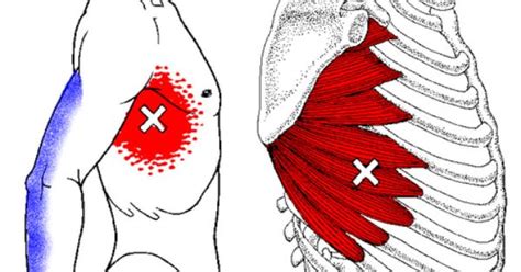 The rib cage is an essential part of the human anatomy and encases the cardiovascular system. Pain+Left+Side+Under+Ribs | Respiration: Pain under my ...