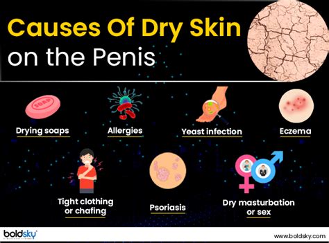 Penile Allergy Causes Home Remedies And Prevention