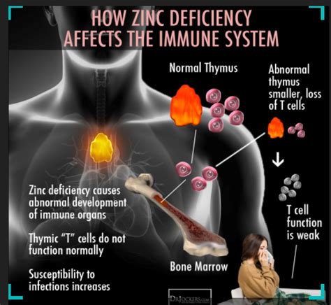 Zinc Helps Against Infection By Tapping Brakes In Immune Response RescueV