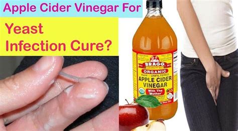 How To Use Apple Cider Vinegar For Yeast Infection Ostomy Lifestyle