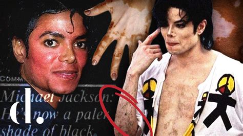 A Deep Analysis Of Michael Jacksons Changing Skin Tone The Detail