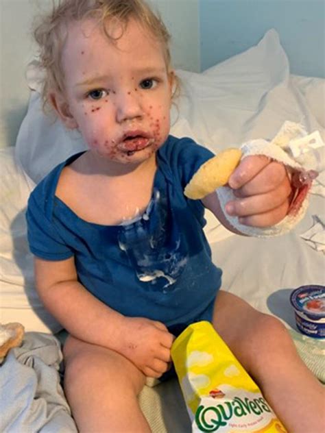 Toddler Becomes Infected With Herpes After Suspected Kiss Photo The