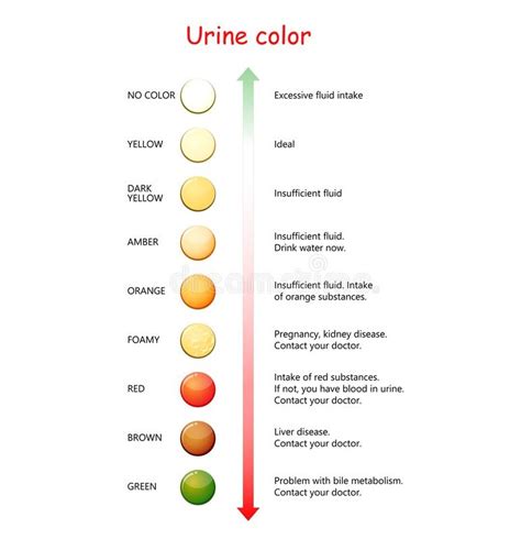 Urine Color Test Examination Causes And More Lab Tests Guide