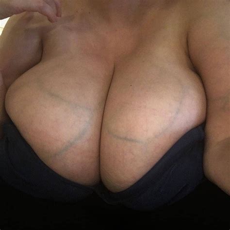 Photo Post Photos Of Huge Super Veiny Boobs Page 12 Lpsg