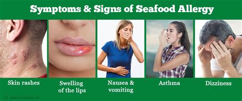 Seafood Allergies And Seaweed Biosea Health Good Food