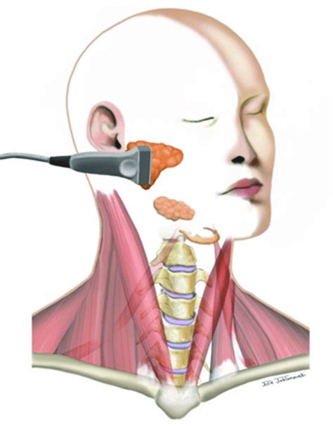 Illustration Demonstrating Ultrasound Scanning Of The Parotid Gland