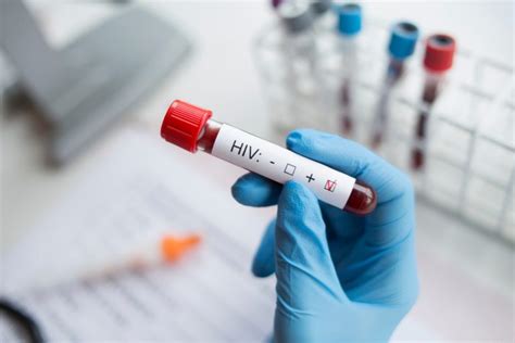 Nice Approves First Long Acting Injectable Hiv 1 Treatment