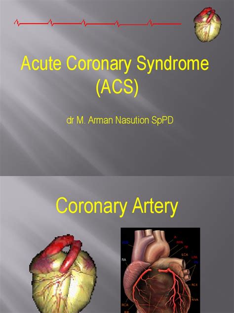Acute Coronary Syndrome Acs Dr M Arman Nasution Sppd