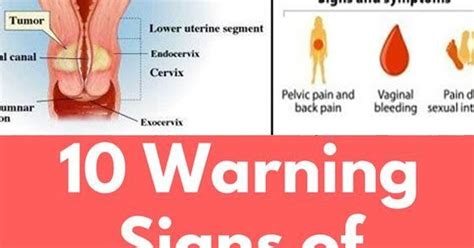 10 Warning Signs Of Cervical Cancer No Woman Should Ignore Hello
