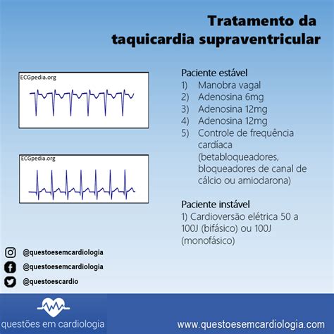 Tratamento Da Taquicardia Supraventricular