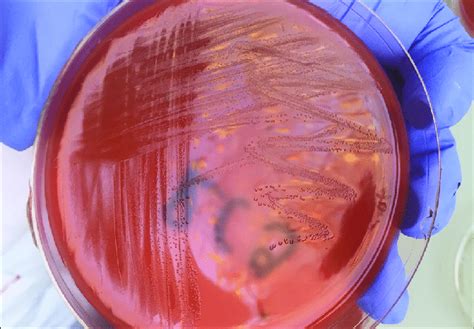 Confirmation Of Enterococcus Faecalis Presence In Lower Chamber Broth