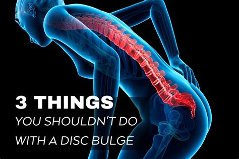 3 things you shouldn t do with a disc bulge perform 360
