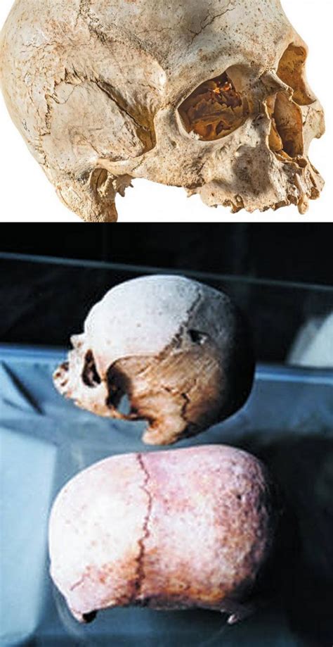 Malta The Elongated Skulls And The Serpent Priests