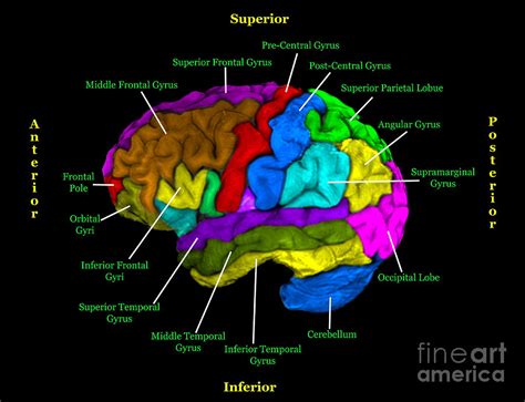 Labeled Mri Of Normal Brain Photograph By Living Art Enterprises My