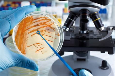 What Is The Purpose Of Microbiological Testing What Types Of Tests Are
