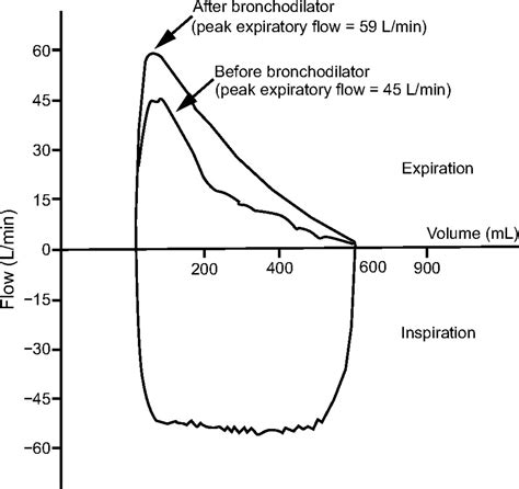 Ventilator Graphics Scalars Loops And Secondary Measures Respiratory