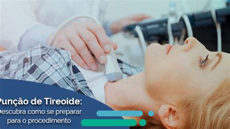 Punção Da Tireoide Precisa De Repouso