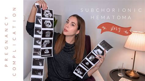Pregnancy Complication Subchorionic Hematoma Private Hospital