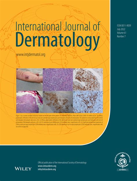 International Journal Of Dermatology Vol 61 No 7
