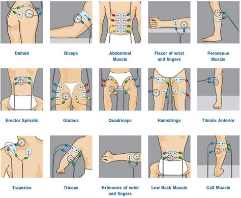 Tens Pad Placement Tens Unit Placement Physical Therapy