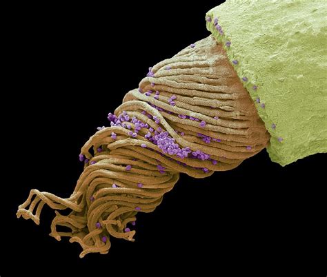 179k likes · 36 talking about this. Moss Spore Capsule Photograph by Steve Gschmeissner/science Photo Library