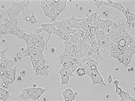 Human embryonic kidney 293 cells, commonly known as hek 293, are a specific cell line which, as the name denotes, were derived from the kidney cells of an aborted human embryo in 1972. Are my 293T cells infected?