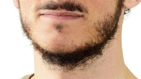 Patchy Beard Solution क्या हल्की दाढ़ी पर चिढ़ाते हैं लोग तो ऐसे