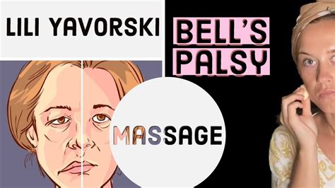 Recovery Bells Palsy Massage Youtube