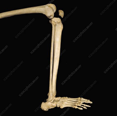 Human Lower Leg Bones Stock Image C0054954 Science Photo Library