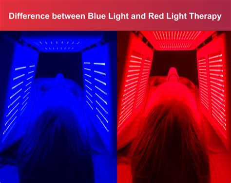 What Is Blue Light Therapy Benefits Side Effects And Recovery
