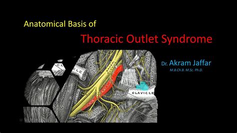 Anatomical Basis Of Thoracic Outlet Syndrome Youtube