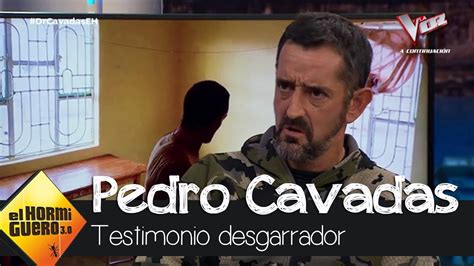 Entrevista A Pedro Cavadas Cirujano Solidario Y Cirujano Solidario