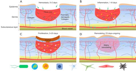 Phases Of Wound Healing