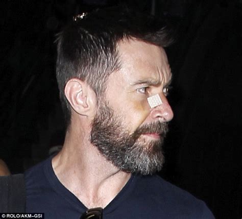 Hugh Jackman Recovering Well From His Second Cancer Removal Operation After Wearing Band Aid