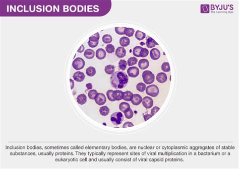 Inclusion Bodies Features And Classifications Of Inclusion Bodies