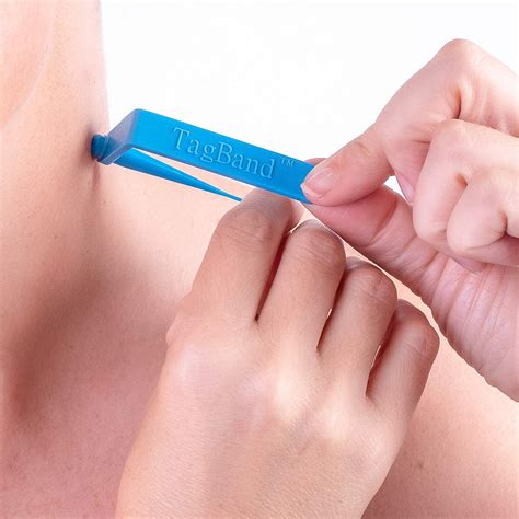 micro tagband skin tag remover device for small to medium size skin tags includes 10x removal