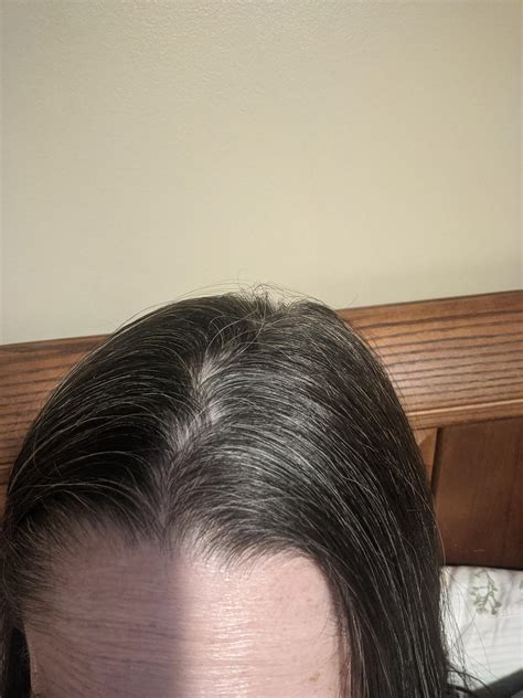 Need Advice On Managing Wiry Grey Hairs Pic Doesnt Show Well But They