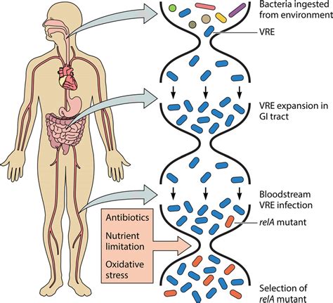 Vre Infection