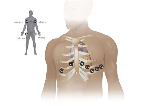 Ecg Lead Placement