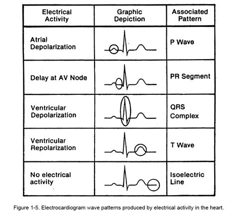 1 05 Graphic Display Of Electrocardiogram C Cardiac Rhythm Interpretation