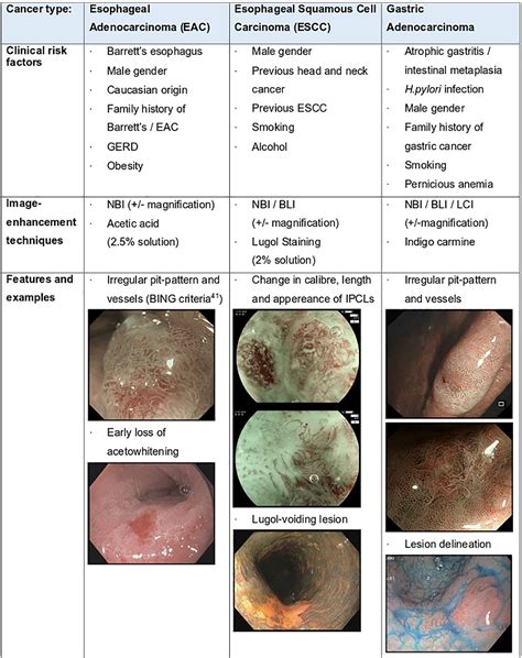 Figure 2 From Quality Indicators In Diagnostic Upper Gastrointestinal