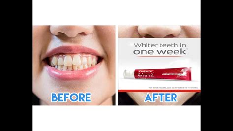 I Tried A Whitening Toothpaste For Days I Before And After I Colgate White Optic YouTube