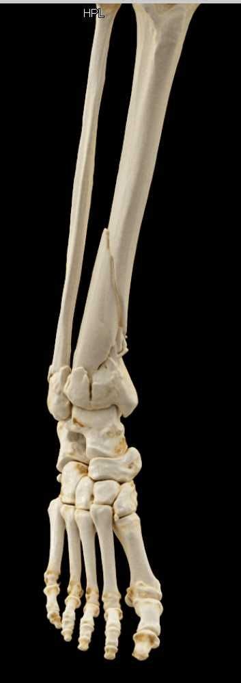Musculoskeletal System Medical Imaging Case Study
