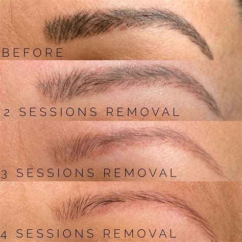 Nano Brows Treatment Everything You Need To Know