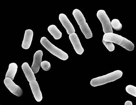 Lactobacillus Sp Rod Prokaryote 2 Photograph By Dennis Kunkel