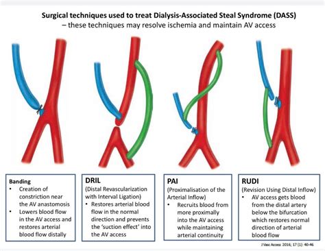 The Surgical Management And Outcomes Of Dialysis Access Associated