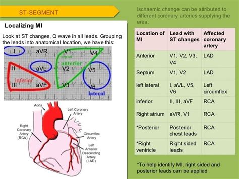 Ecg 78 728 728×546 Arteries Anatomy Ekg Leads Arteries