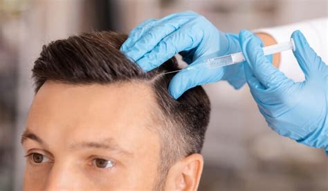 Non Surgical Hair Transplant Stitch Less And Painless Hair Treatment Procedure Apex Hair And